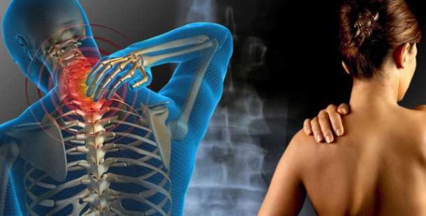 fibromialgia