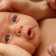 osteopatia-neonatale