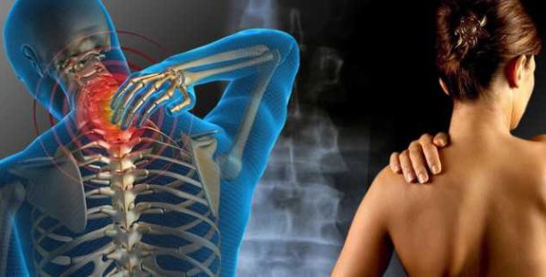 fibromialgia